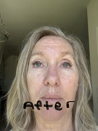 After photo by Barbara Davis